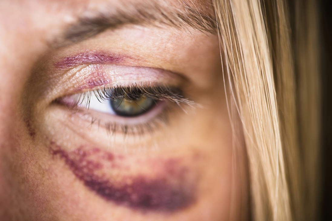 bántalmazás, erőszak, gyermekkorban, szexuális bűncselekmény nem évül el