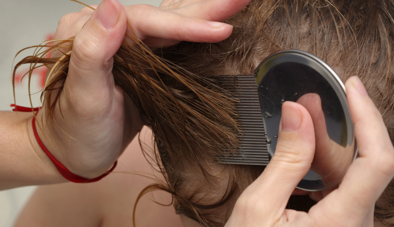 A fejtetvesség krízis. A fejtetvesség határátlépés - avgy mit tehetünk, ha egy közösségben megjelenik a fejtetű?